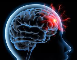 Conférence sur l'AVC: un accident qui nous tou ...