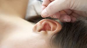 Conférence sur l'auriculothérapie